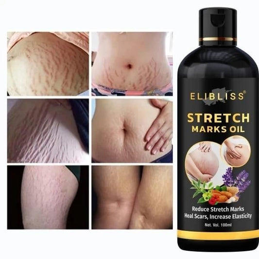 Stretch Marks Oil